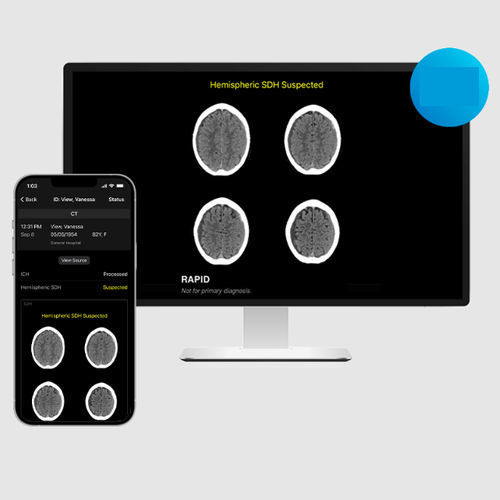 Software de tratamiento - SDH - RapidAI - médico / de hospital / TDM