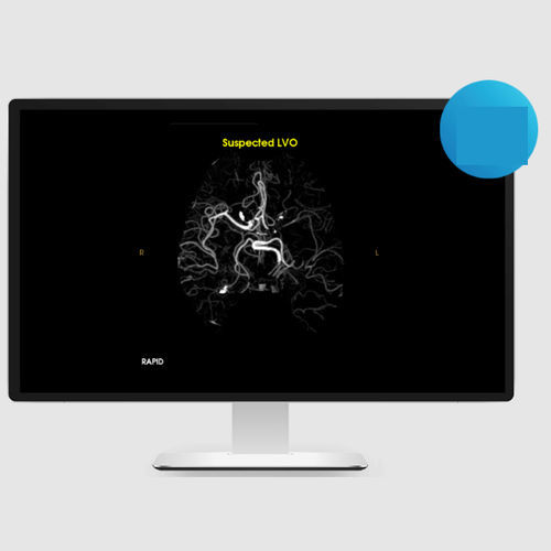 Software para diagnóstico de ictus - LVO - RapidAI - de validación / médico / de la arteria carótida interna