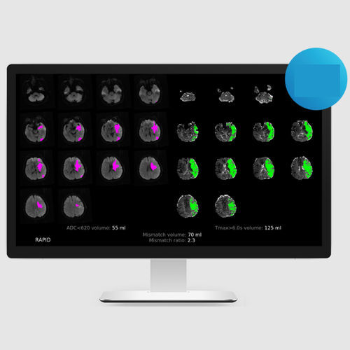 Software de análisis de imágenes - MRI - RapidAI - de captura / médico / clínico