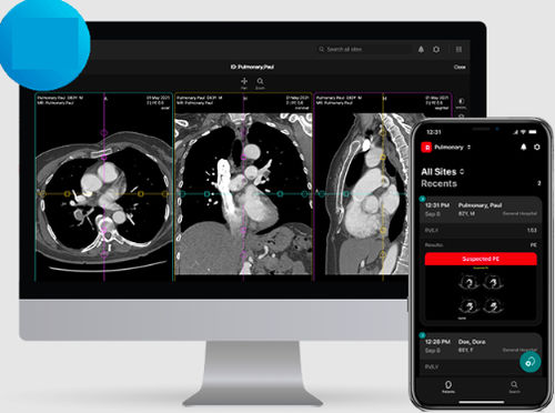 Software médico - PE - RapidAI - clínico / visualizador / de diagnóstico