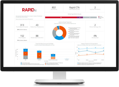 Software médico - RapidAI - de hospital / clínico / análisis de datos