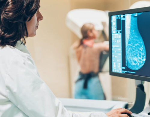 Plataforma de IA médica - Mia IQ™ - Kheiron Medical Technologies - de detección / de formación