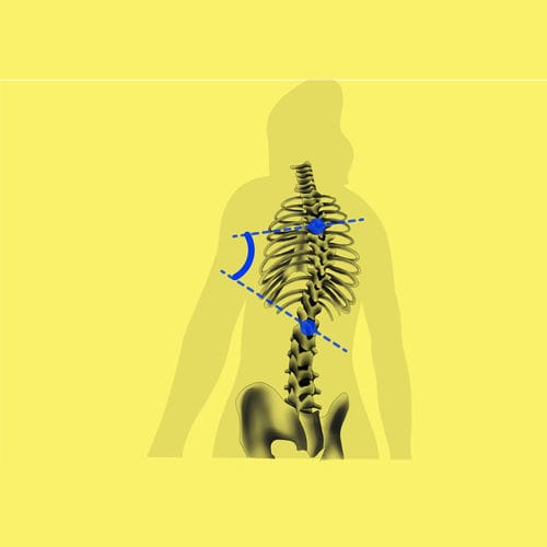 Software de interpretación - BoneMetrics - Gleamer - de estandarización / médico / clínico