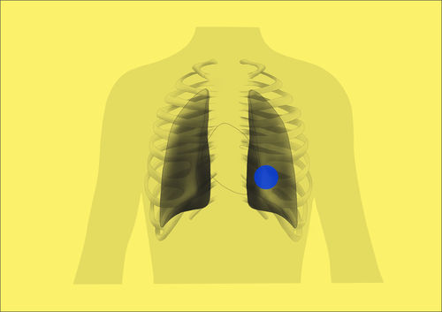 Software de diseño - ChestView - Gleamer - de captura / médico / TDM