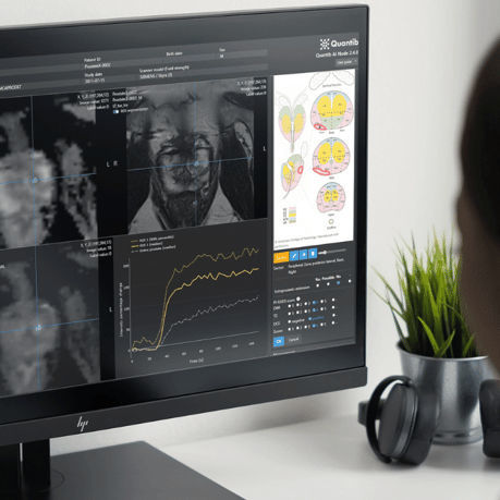 Software de radiología - QUANTIB® - Quantib B.V. - de análisis de imágenes / de evaluación / de próstata