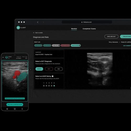 Software de formación - ThinkSono - para ecografía