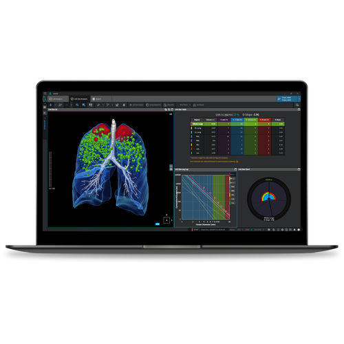 Software médico - COPD - Coreline - clínico / para la investigación / de análisis