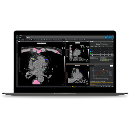 Software médico - CAC - Coreline - TDM / cardiovascular / de análisis