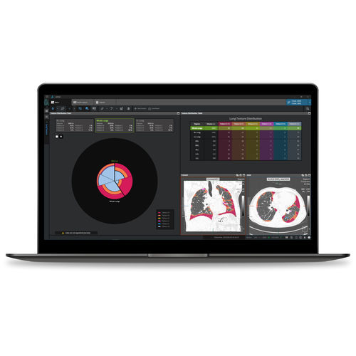 Software médico - Coreline - de análisis / para informes / de interpretación