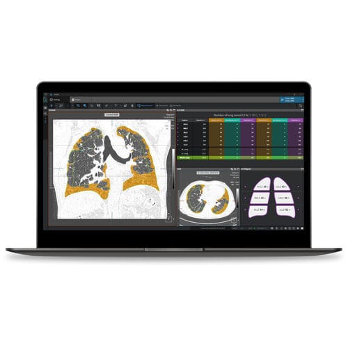 Software médico - ILA - Coreline - de análisis / para informes / de pulmón