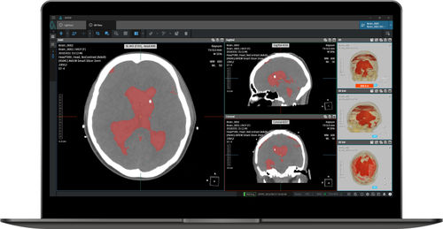 Software médico - NeuroCAD - Coreline - de emergencia / TDM / de análisis