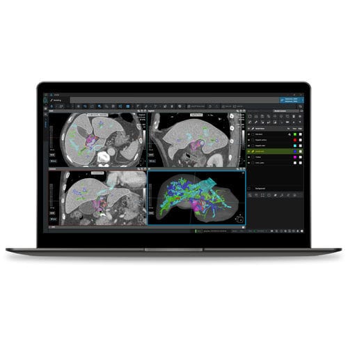 Software médico - Coreline - TDM / de gestión de datos / visualizador