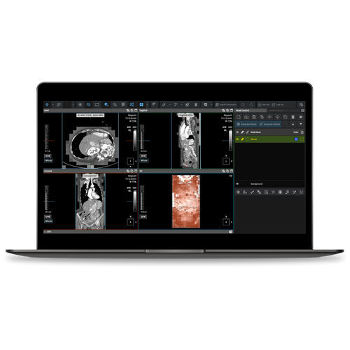 Software servidor - Coreline - médico / TDM / para IRM