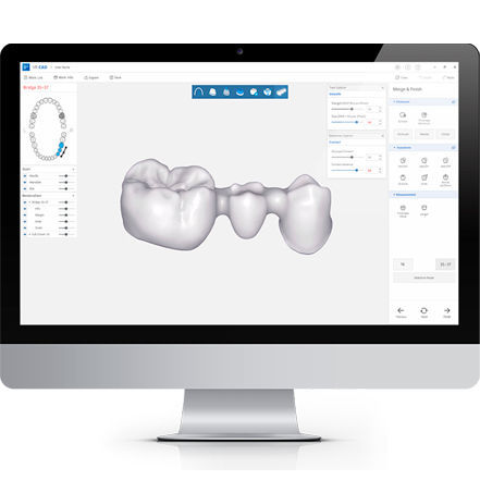 Software clínico - DESIGN+ - DDS Inc - para odontología / de diseño / de CAD
