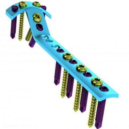 Placa de compresión para tibia - 5709-002-0 series - Ortobio - porción proximal / bloqueada / de titanio
