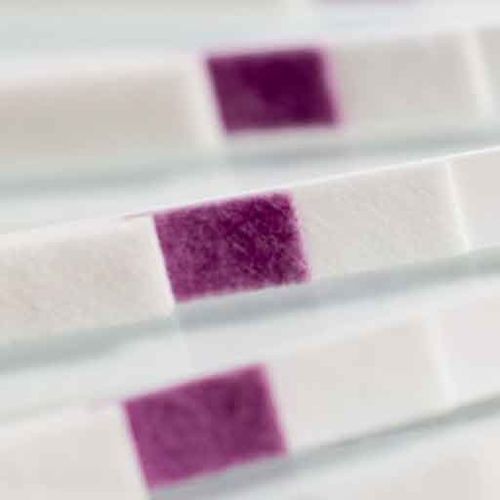 Tira de prueba de enfermedades renales - GBR-3409 - Golden BioTechnologies - de adenosín monofosfato / de orina / de superficie