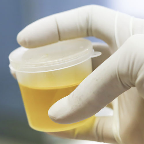 Kit de prueba para purificación del ADN - MagSi - magtivio B.V. - de sangre / de suero / por plasma
