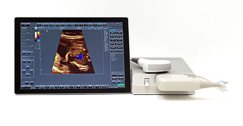Ecógrafo portátil - SmartUs  - TELEMED - para ecografía polivalente / blanco y negro / doppler-color