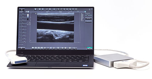 Ecógrafo en plataforma, de mesa - MicrUs - TELEMED - para ecografía polivalente / blanco y negro
