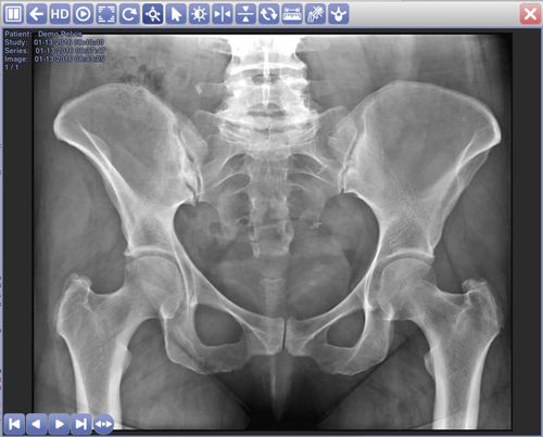 PACS con computación en la nube - AccuVueCloud - Radmedix - para imágenes médicas
