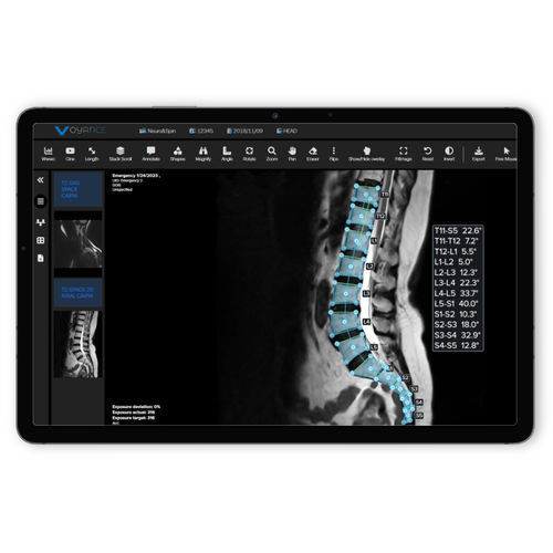 PACS para imágenes médicas - vpax.ai - voyance - procesos basados en la web
