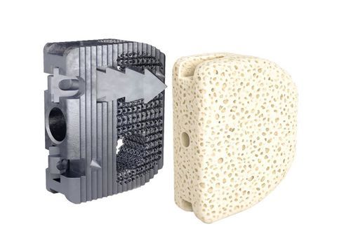 Caja intersomática cervical - Monza  - Clover Next - vía anterior / de titanio / impresa en 3D