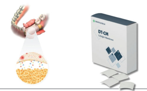 Matriz tisular cirugía dental - DT-CM - DENTAL TECH S.R.L. - colágeno / reabsorbible