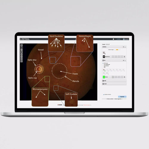 Plataforma de IA para oftalmología - UMI DR - ULMA Medical Technologies - de diagnóstico / de detección