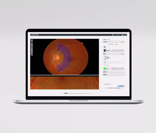 Módulo de software de medición - UMI AVR - ULMA Medical Technologies - para oftalmología / de retina / de arteria