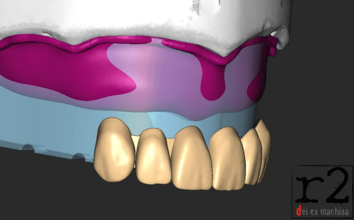 Software para odontología - BiteReg  - Dentona AG - de diseño / de importación / de impresión 3D