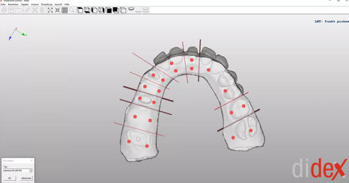 Software de laboratorio dental - didex  - Dentona AG - de captura / de impresión 3D / de modelado