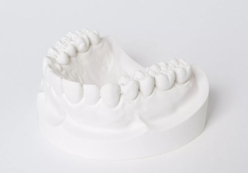 Material dental de yeso - dento-stone® 220  - Dentona AG - de fundición / para la fabricación de dentaduras postizas / de modelización