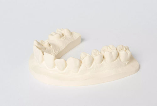 Material dental de piedra - No. 1 - Dentona AG - para laboratorio dental / de modelización