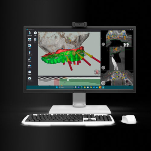 Software de tratamiento - M3013D - MAG - ADVAN S.r.l. - de planificación / de diseño / médico