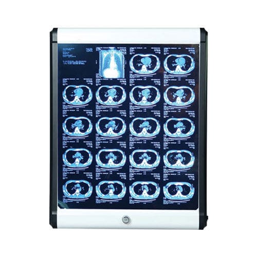 Negatoscopio 1 pantalla - SSMEC-VB-100 - Samsung Medi Engineering