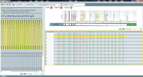 Software de análisis - SwIm03 - TestLine Clinical Diagnostics - médico / de laboratorio / para inmunoblot