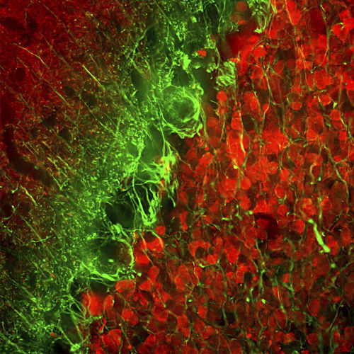 Reactivo para alfa-internexina - MO22154 - Neuromics - anticuerpo monoclonal / IgG / para la investigación científica