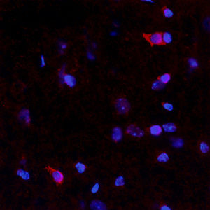 Reactivo anticuerpos - RA21023 - Neuromics - para la investigación científica / para western blot / para inmunohistoquímica