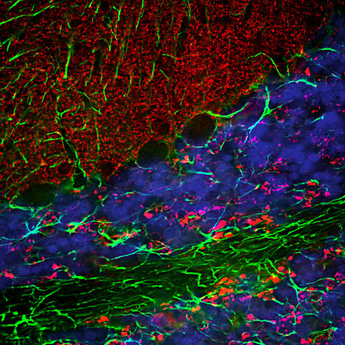 Reactivo anticuerpos - CH22139 - Neuromics - para western blot / para inmunohistoquímica / para inmunofluorescencia