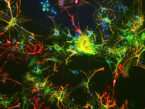 Reactivo anticuerpo monoclonal - MO22143 - Neuromics - para la investigación científica / para western blot / para inmunohistoquímica