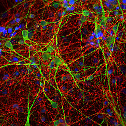 Reactivo anticuerpos - MO22170 - Neuromics - para la investigación científica / para western blot / para inmunohistoquímica