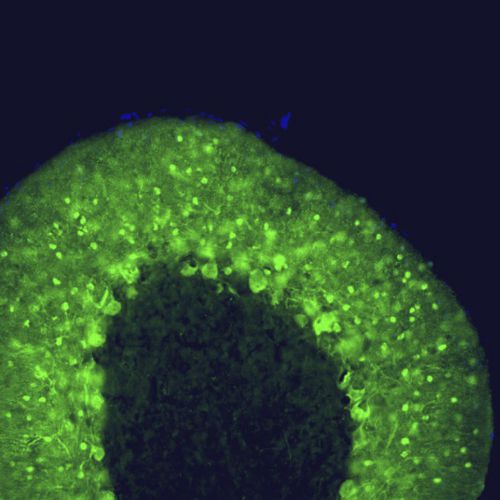 Reactivo IgG - MO22149 - Neuromics - para la investigación científica / para western blot / para inmunohistoquímica