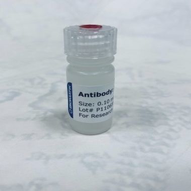Reactivo anticuerpo policlonal - CAU21001 - Biomatik - para la investigación / líquido / a base de animales
