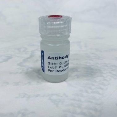 Reactivo anticuerpo policlonal - CAU21006 - Biomatik - para la investigación / líquido / de proteínas