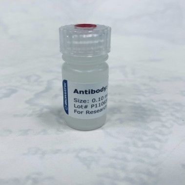 Reactivo anticuerpo policlonal - CAU21008 - Biomatik - para la investigación / líquido / de proteínas