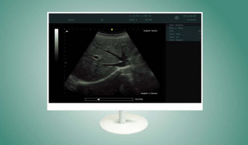Monitor médico - MS2210 - ZRT Technology - para endoscopia / 1920 x 1080 / 21,5"