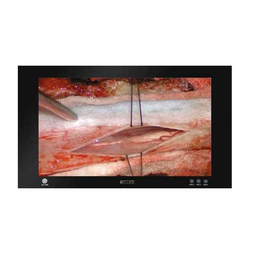 Monitor médico - MD8650T - ZRT Technology - para sala de operaciones / para endoscopia / 3.840x 2.160