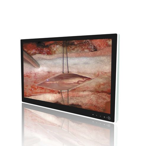 Monitor médico - MS8270P - ZRT Technology - para sala de operaciones / para endoscopia / 3.840x 2.160