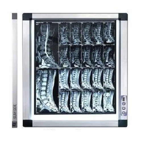 Negatoscopio digital - MV-FV4 - Mediveron - 1 pantalla / LED / con intensidad luminosa ajustable