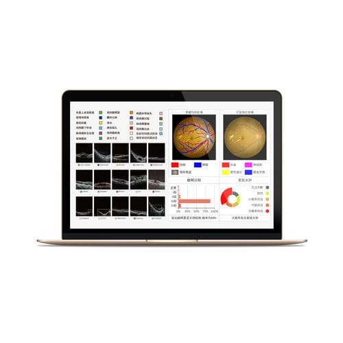 Software de análisis - MIAS - Big Vision Medical - de diagnóstico / de detección / médico